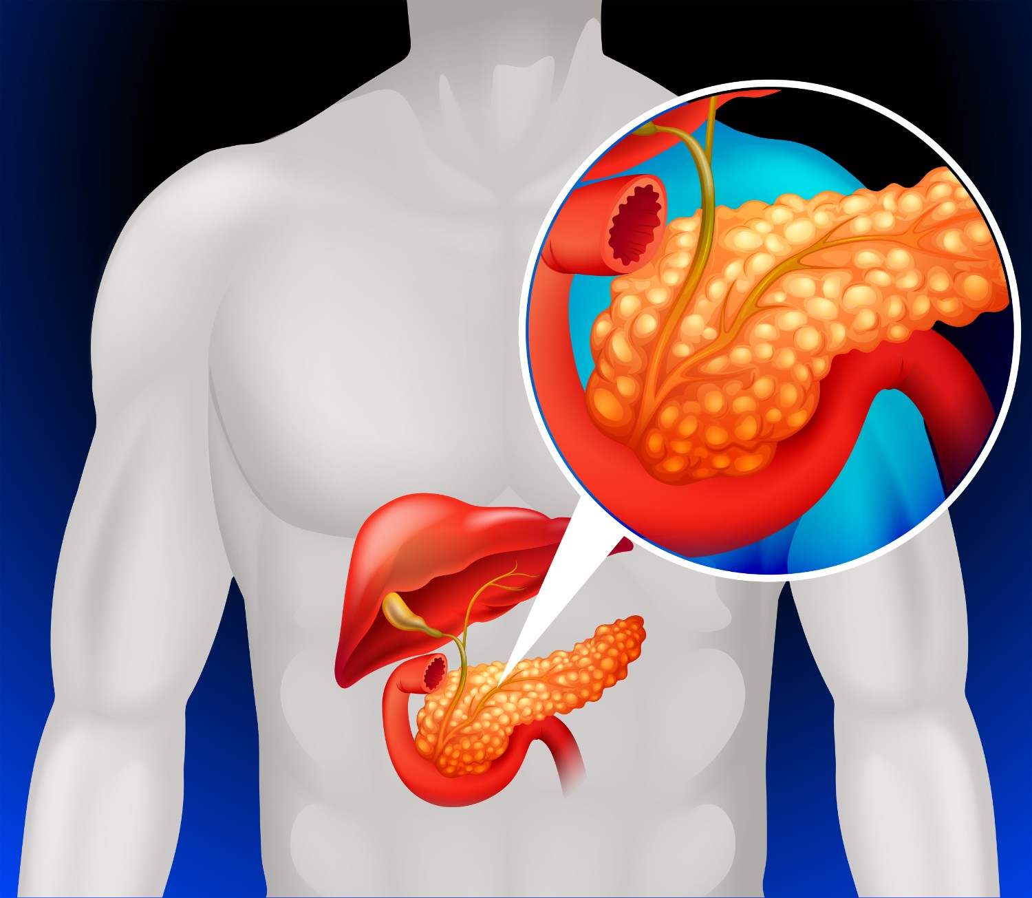 Dr. Akshay Kulkarni - Pancreas Specialist in Aurangabad